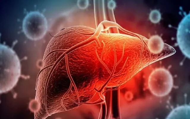 مراحل تبدیل شدن کبد چرب به بیماری‌های خطرناک