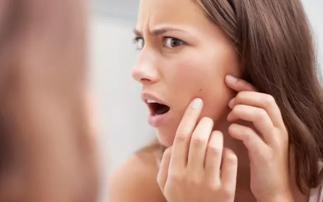 پوستت بعد از یک محصول جدید پر از جوش شده؟ این ۶ نشانه را بررسی کن