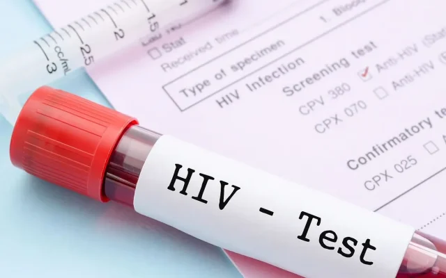 ترکیب دارویی جدید می‌تواند ویروس HIV را در بیمارانی که به درمان مقاوم شده‌اند، کنترل کند